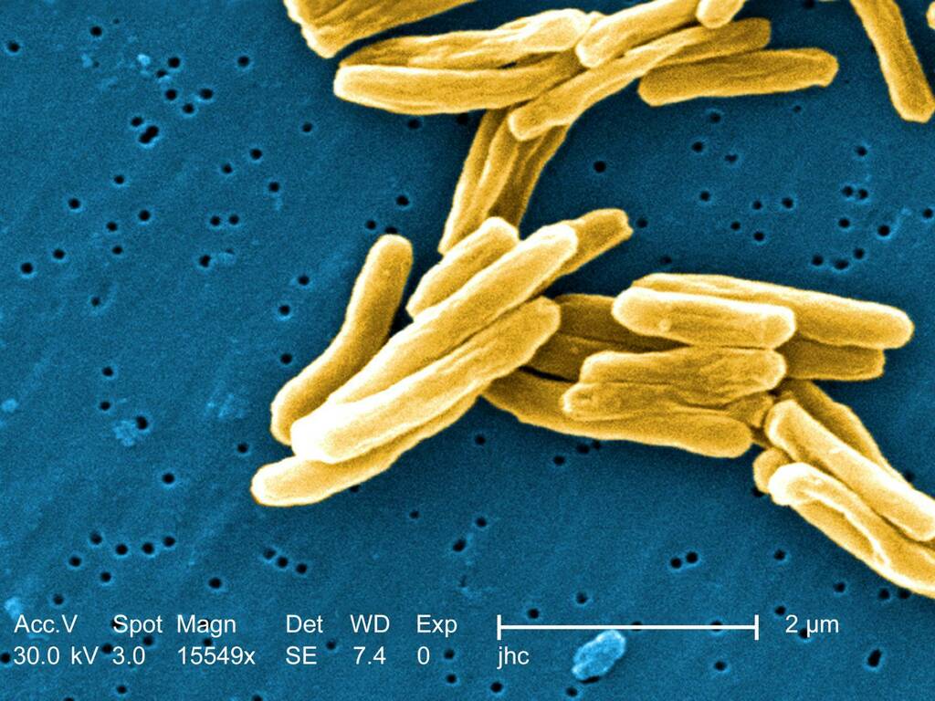batterio tubercolosi (Foto Pixnio)